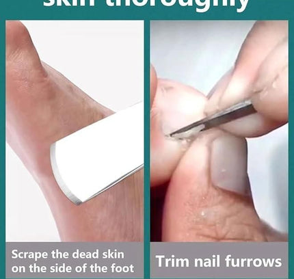 5 Pieces Pedicure Knife Set with Storage Case