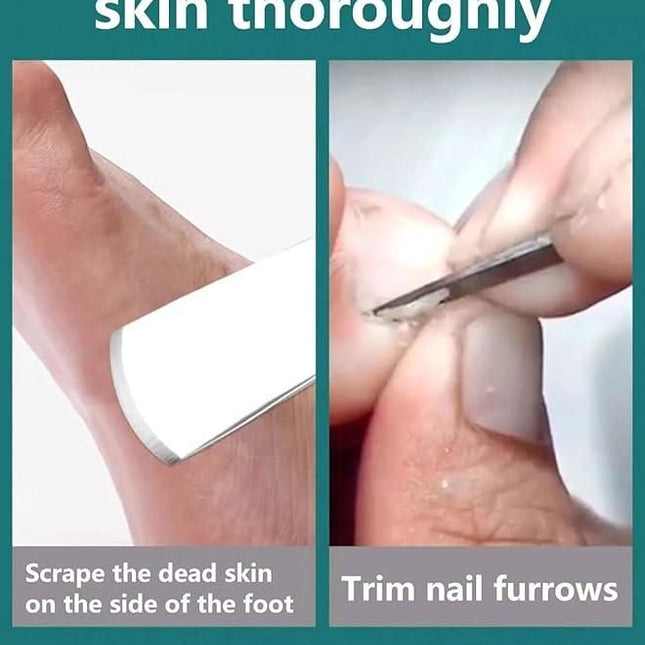 5 Pieces Pedicure Knife Set with Storage Case